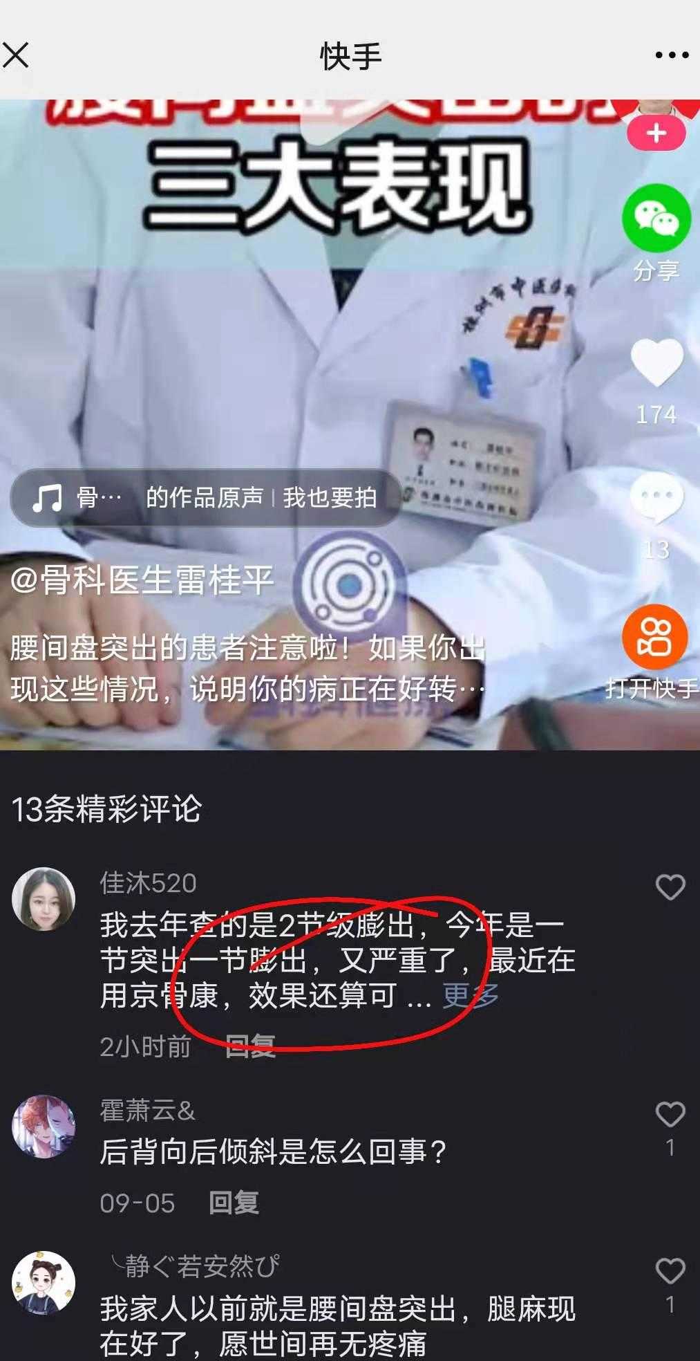 快手点赞1元100个赞_快手点赞业务五十个赞_快手1元100赞怎么弄