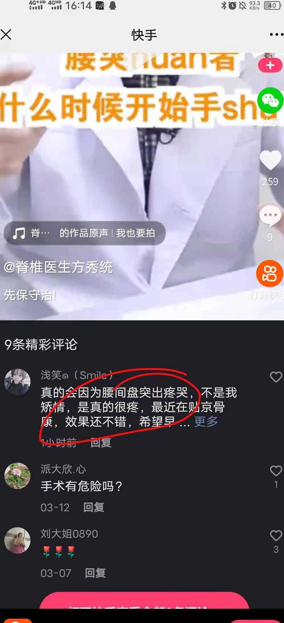 快手买赞50个赞_买赞1毛1000赞快手平台_快手赞