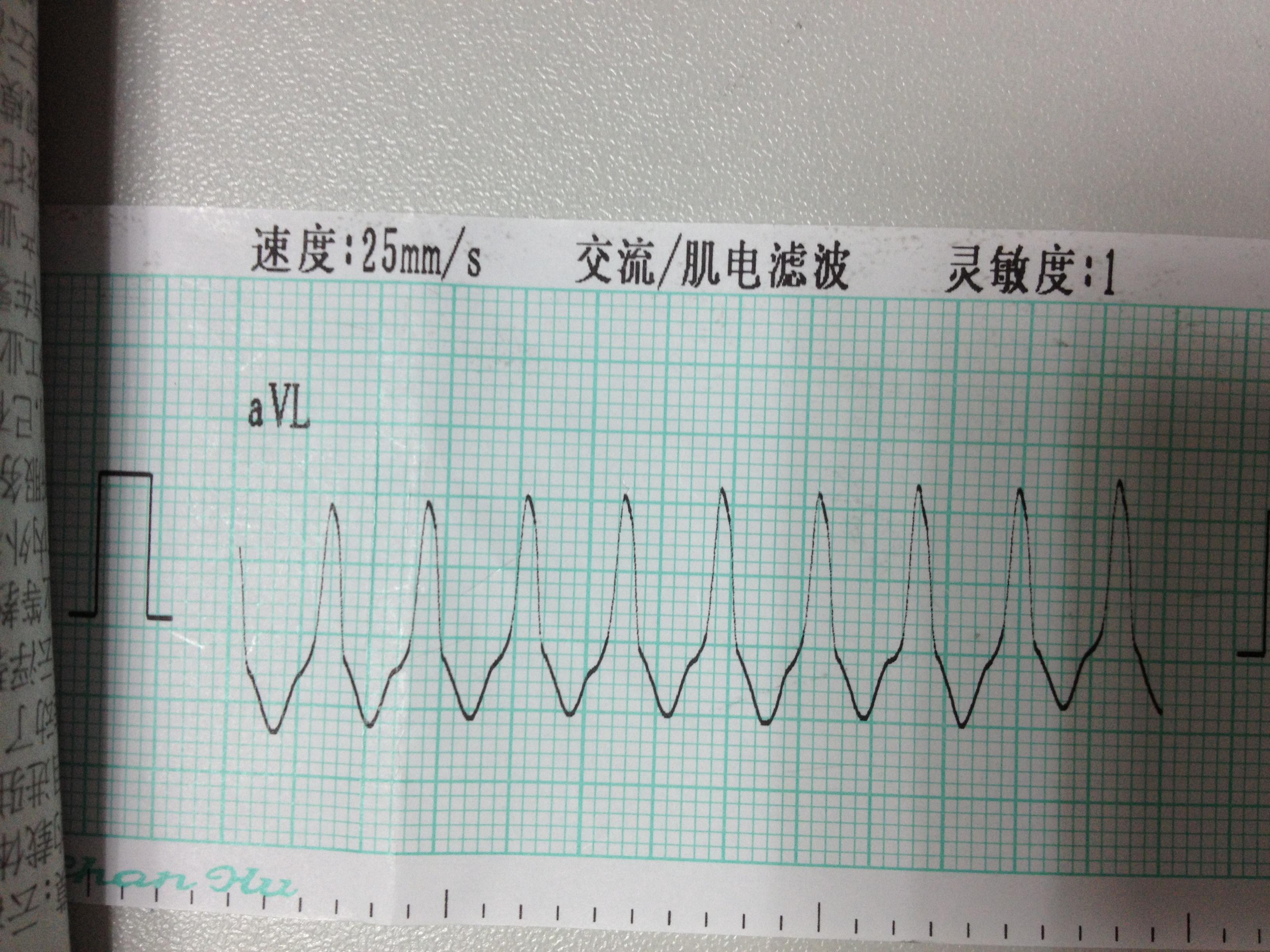 薛平贵是唐朝哪个皇帝相关推荐_心跳过快是什么原因相关推荐_粉刺是怎么形成的相关推荐